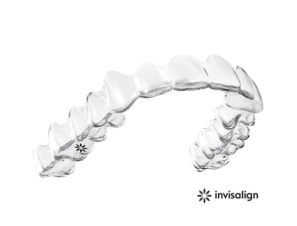 invisalign spange